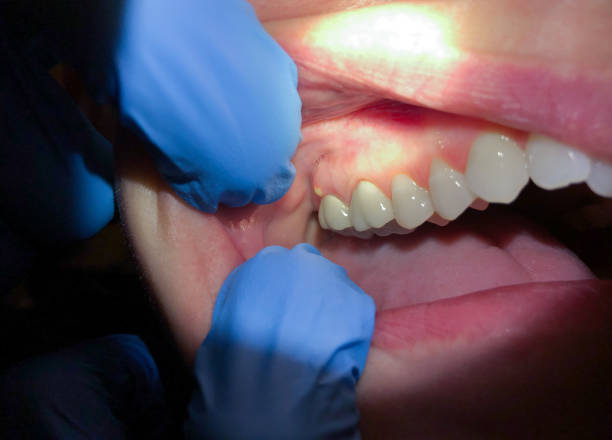 Best Emergency Gum Pain Relief  in Hoisington, KS